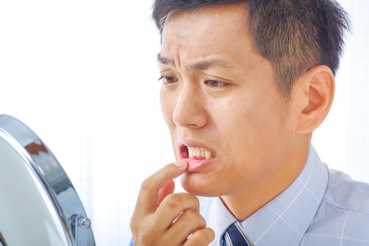 歯周病治療のイメージ画像