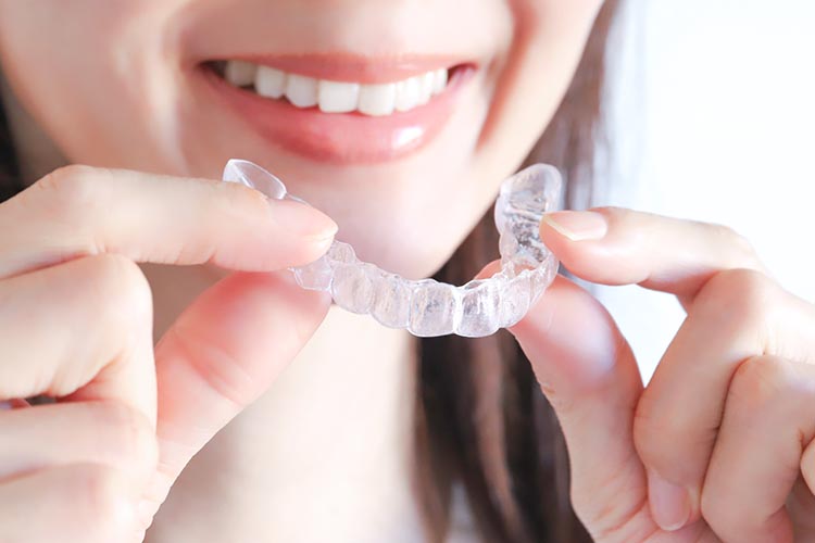 マウスピース矯正のイメージ画像