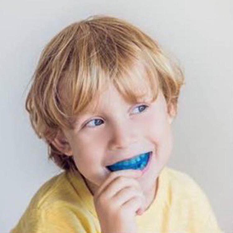 小児矯正のイメージ画像