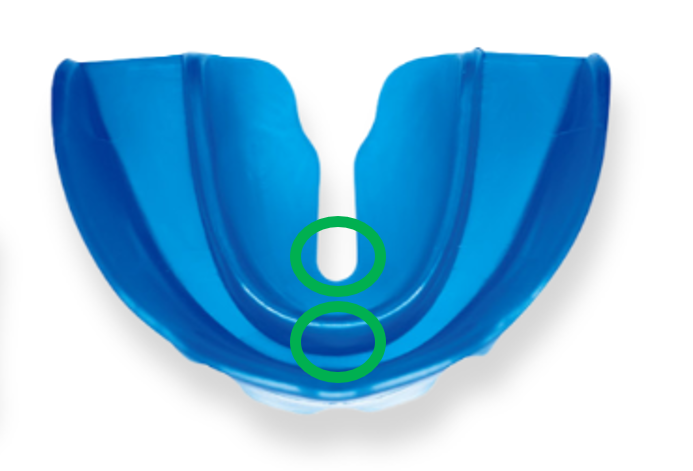 プレオルソの画像2