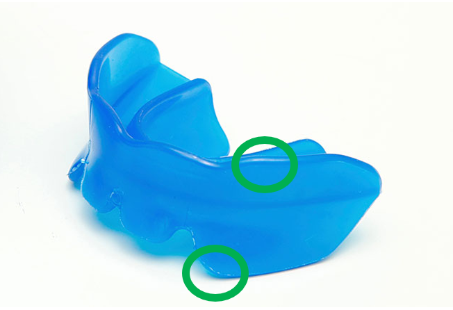 プレオルソの画像3