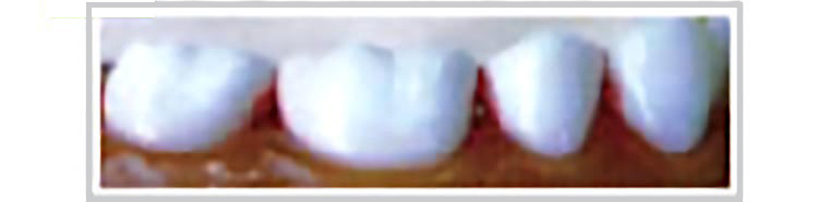 きれいに磨かれた歯の画像